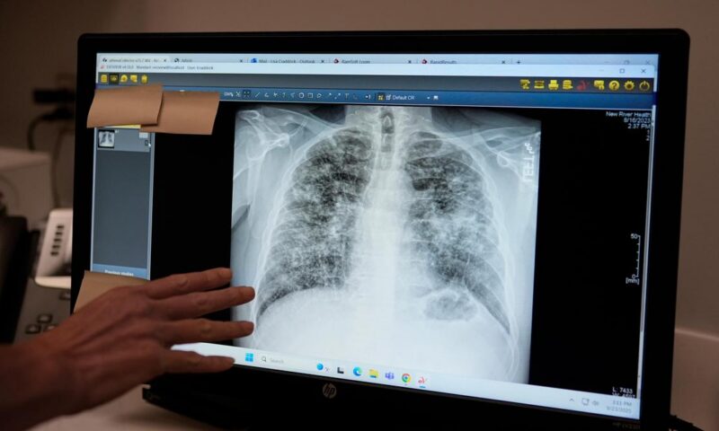 Lung cancer: a scan that detects early and an injection that may prevent it