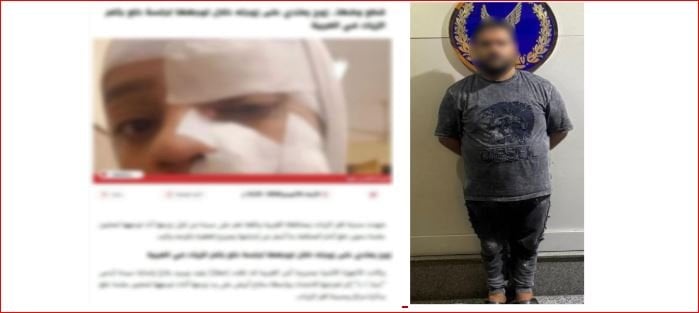 من دعوى الخلع إلى «تشويه الوجه».. تفاصيل صادمة في واقعة التعدي على «سيدة الغربية»