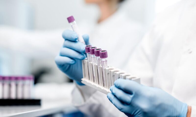 How liquid biopsy could help detect pregnancy risks earlier