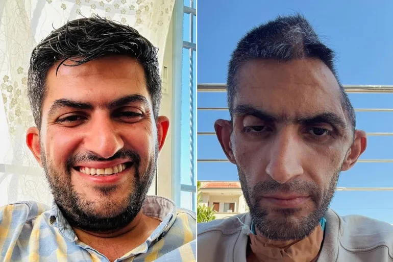 مجاهد بني مفلح.. صورة تفضح إجرام الاحتلال في السجون