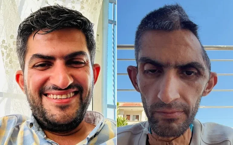 “عمرٌ من الوجع”.. صورة صادمة وشهادة مؤثرة للصحفي مجاهد بني مفلح تفضح آثار التعذيب في سجون الاحتلال