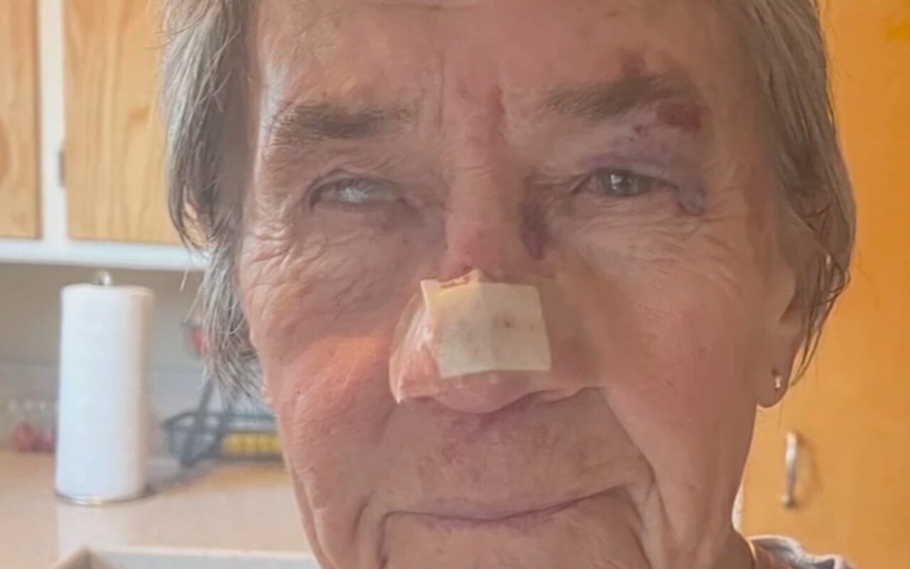California woman, 83, left with horrific injuries after being attacked by gang of wild turkeys