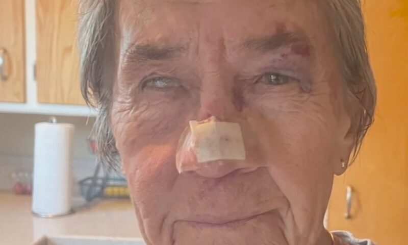 California woman, 83, left with horrific injuries after being attacked by gang of wild turkeys