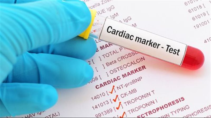 أعراض وأسباب ارتفاع أنزيمات القلب ومخاطر ذلك