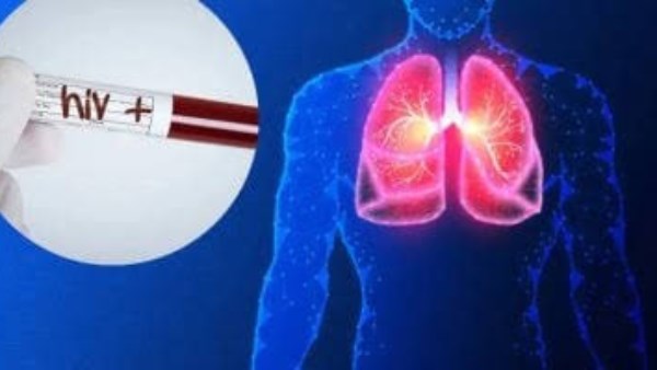 كيف نجحت مصر في خفض معدلات تليف وسرطان الكبد؟ أسرار المعركة