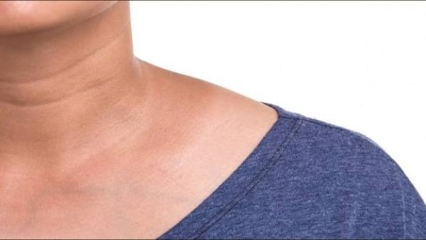 احذر من تجاهلها.. علامات وأعراض مقاومة الإنسولين المبكرة وطرق الوقاية