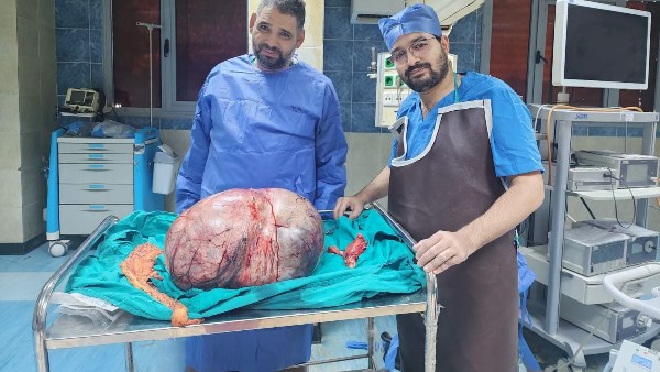 جامعة المنيا: نمتلك كوادر قادرة طبية تسطيع إجراء أدق الجراحات المعقدة