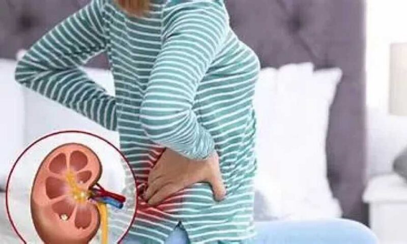 5 طرق منزلية تساعد في التخلص من حصوات الكلى والوقاية منها