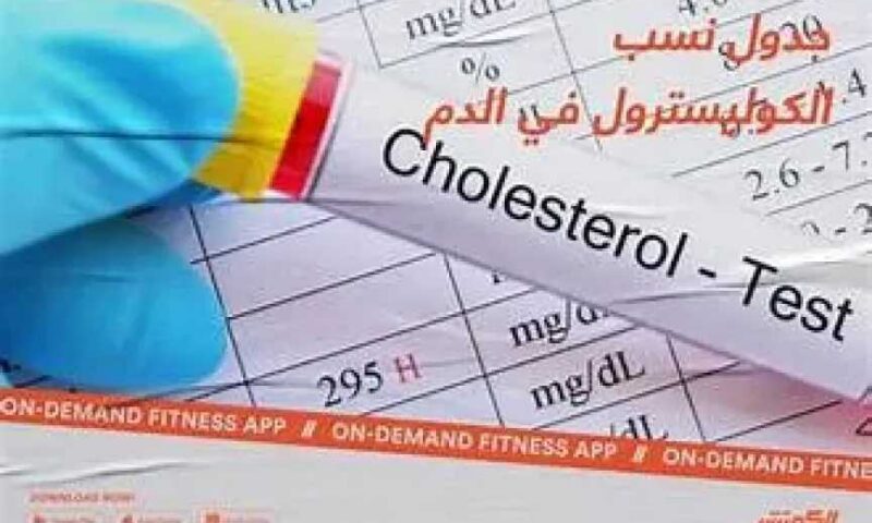 كل كم سنة يجب فحص الكوليسترول؟ : مواعيد التحليل والفئات الأكثر احتياجًا للمتابعة الدورية
