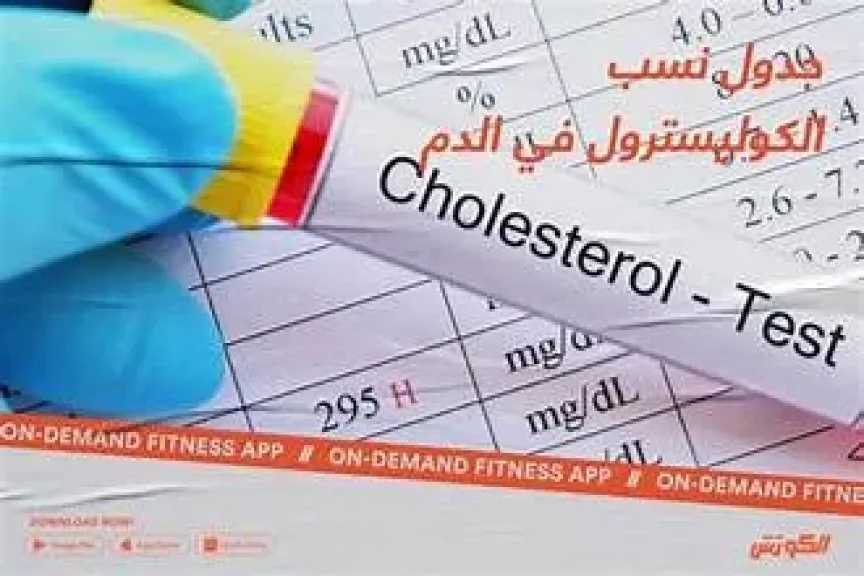 كل كم سنة يجب فحص الكوليسترول؟ : مواعيد التحليل والفئات الأكثر احتياجًا للمتابعة الدورية