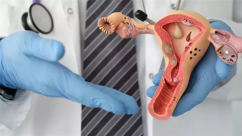 أعراض وأسباب السقوط الرحمي وطرق العلاج