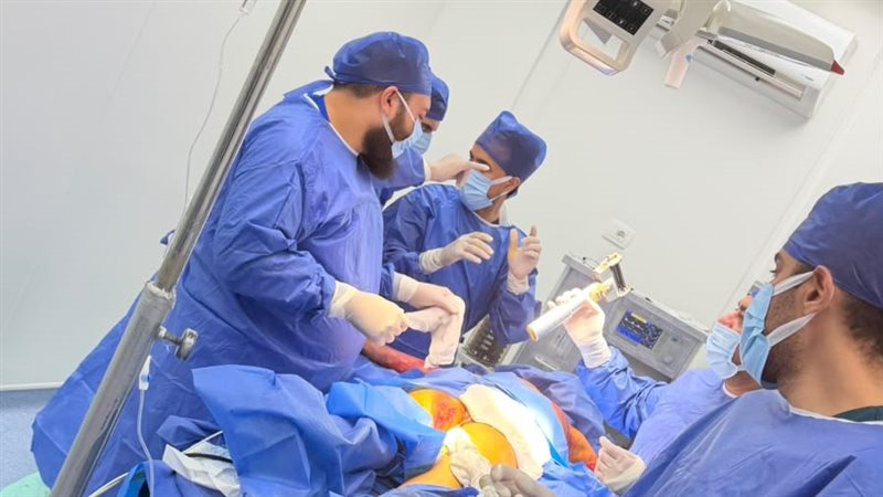 مستشفى السنبلاوين العام تنجح في إجراء أول عملية ترقيع جلدي لطفل مصاب بحروق واسعة