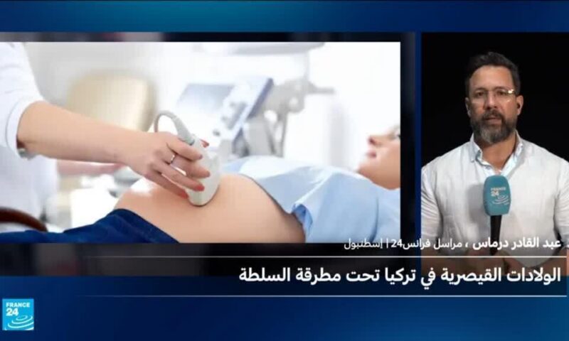 جدل في تركيا بعد توقيف 100 طبيب بسبب ارتفاع الولادات القيصرية