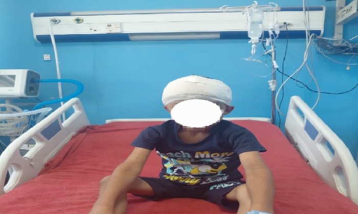 جراحة نادرة بمستشفيات سوهاج الجامعية.. استخراج رصاصة طائشة من مخ طفل وإنقاذه دون مضاعفات