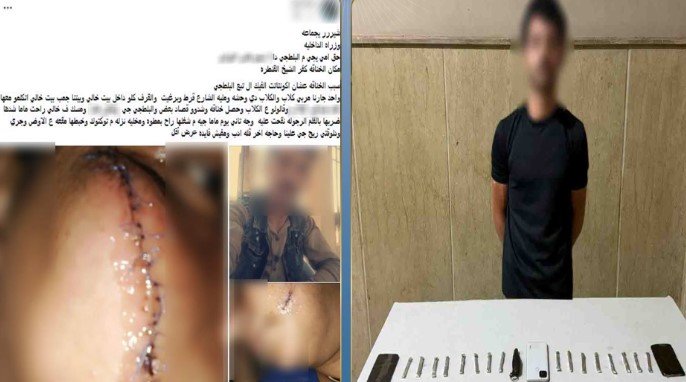 الداخلية تكشف ملابسات الاعتداء على سيدة بسلاح أبيض في كفر الشيخ