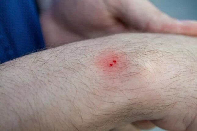 ماذا تفعل إذا لدغك ثعبان؟.. نقيب الأطباء البيطريين السابق يُجيب