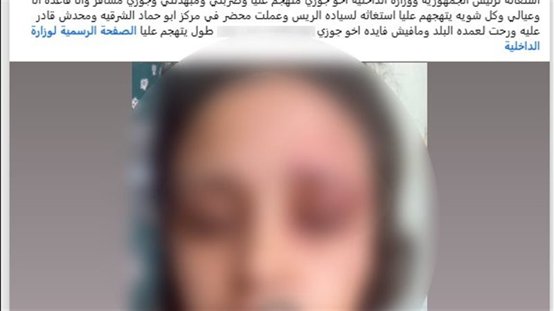 خلافات عائلية تنتهي بالضرب، ضبط المتهم بالاعتداء على زوجة شقيقه في الشرقية
