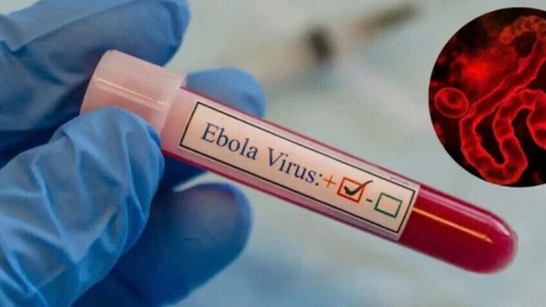 الصحة العالمية توصي بإدراج لقاح «أرفيبو» في تجربة سريرية لمواجهة إيبولا بالكونغو
