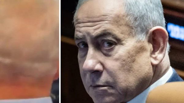 ماذا يخفي رأس نتنياهو؟ علامة غامضة أربكت الإسرائيليين