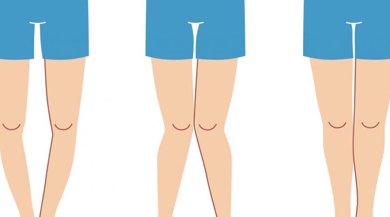 احترس.. اشياء غير متوقعة تسبب الكساح