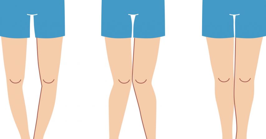 احترس.. اشياء غير متوقعة تسبب الكساح