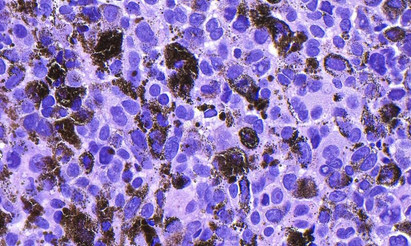 لقاح mRNA لعلاج سرطان الجلد ينجح في المرحلة الثالثة.. وسهم “مودرنا” يقفز 160%
