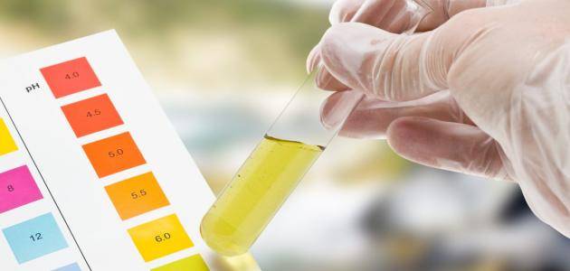 أسباب لون البول البرتقالي.. متى يكون طبيعيًا ومتى يحتاج إلى طبيب؟