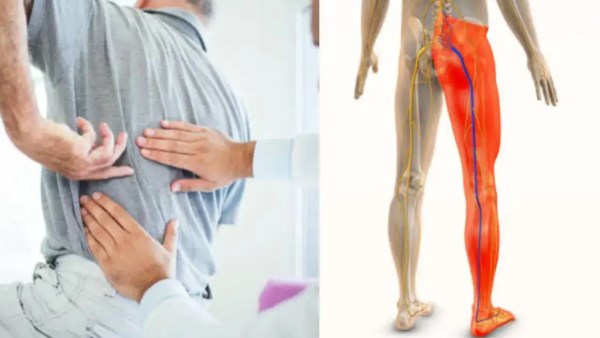 الأسباب الخفية وراء ألم الساق .. يجب حماية العمود الفقري وتعديل النشاط