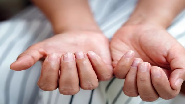 منها الصداع والدوخة.. 7 علامات صامتة لنقص الحديد عند النساء