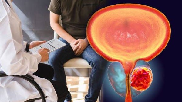 هل تضخم البروستاتا يمنع الإنجاب؟ استشاري مسالك يوضح