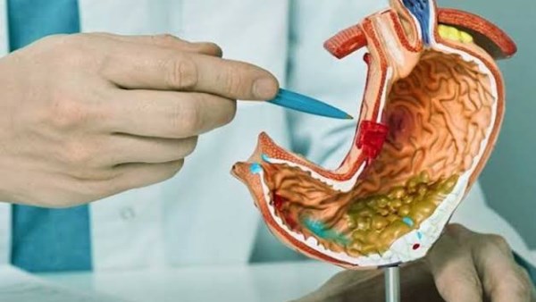 علامات خفية في الجهاز الهضمي قد تنذر بسرطان المعدة.. لا تتجاهل هذه الأعراض المبكرة