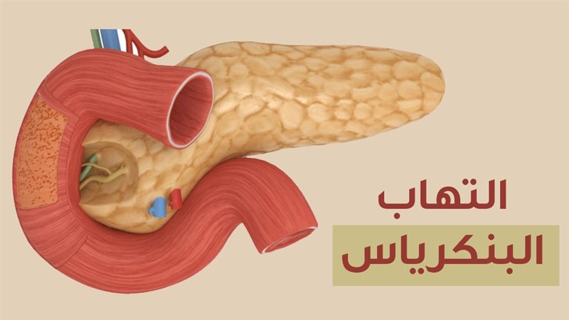أعراض التهاب البنكرياس، استشاري باطنة يوضح ويحذر من إهمالها
