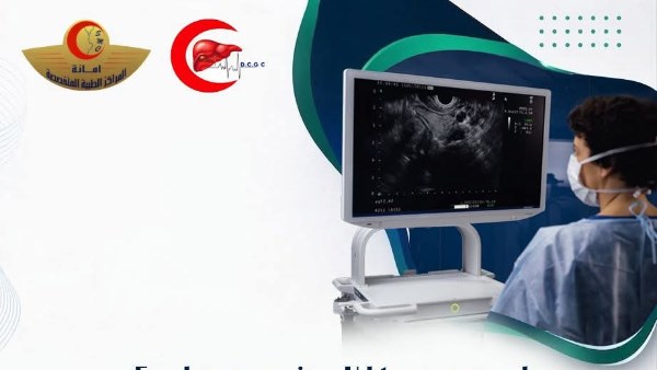 لأول مرة بدمياط.. استخدام واحد من أحدث مناظير الموجات فوق الصوتية بمركز القلب والجهاز الهضمي