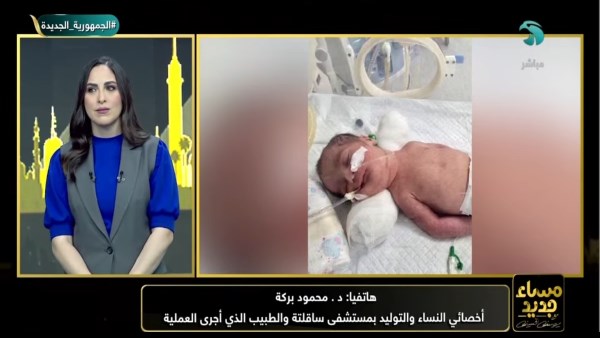 كيف ولد توأم حيًا بعد وفاة أمهما بسوهاج؟ أخصائي نساء يكشف التفاصيل
