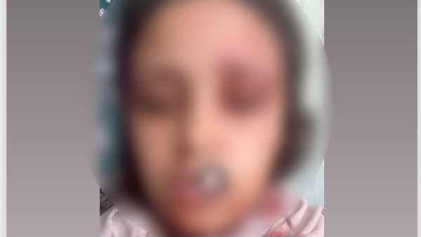 راحت المستشفى.. ضبط عامل تعدى على زوجة شقيقه بالضرب في الشرقية