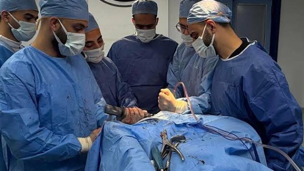 إجراء 4 عمليات جراحية ذات مهارة للعظام بمستشفى العريش العام