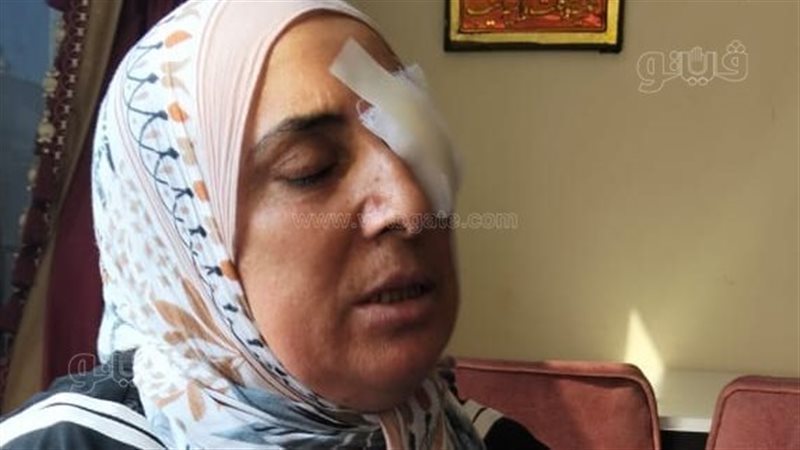 أقاربها استولوا على حقها في أرض المانجو، سيدة بالإسماعيلية تتعرض للضرب والسحل وتفقد عينها