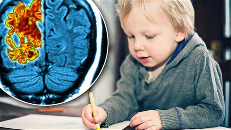 دراسة تكشف رابطا بين مرض وراثي نادر لدى الأطفال وألزهايمر
