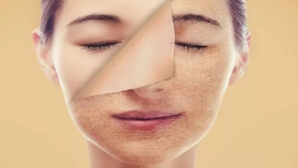 من انتفاخ العينين إلى تغير لون البشرة.. علامات على الوجه قد ترتبط بمشكلات الكلى