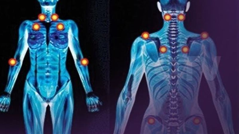 10 نصائح تساعد فى علاج مرض الفايبروميالجيا