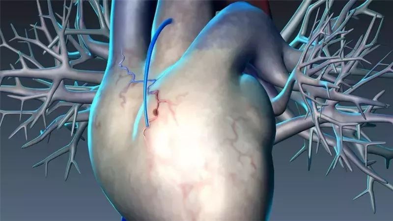 ليست نتيجة إرهاق.. 5 علامات تنذر بقرب حدوث جلطة قلبية