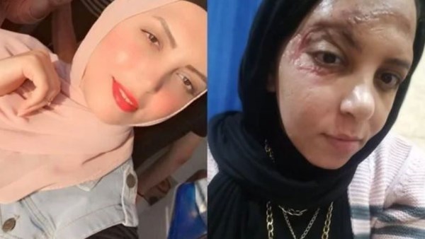 ضبط المتهم بدهس فتاة برج العرب عقب هروبه عامين من تنفيذ حكم الحبس