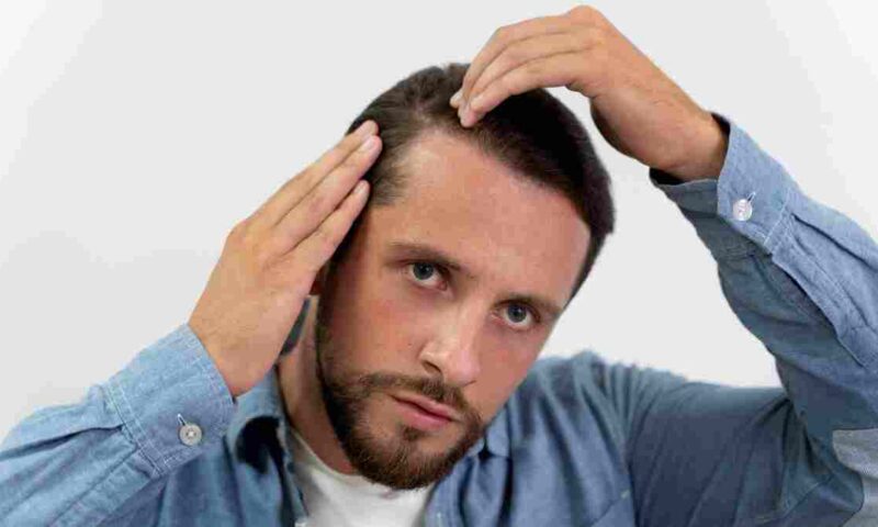 جفاف الفروة والقشرة.. مشكلتان مختلفتان يعاني منهما الرجال