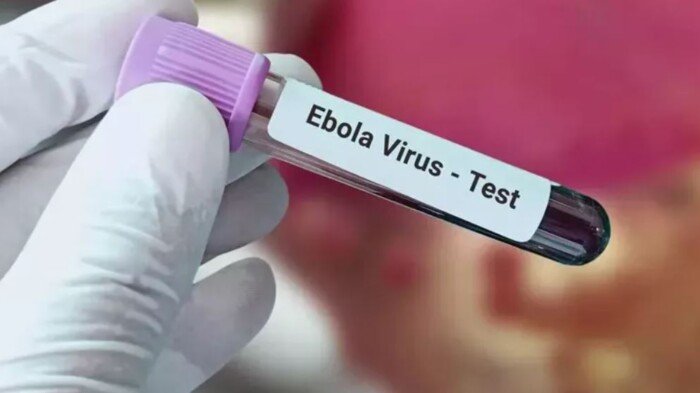 الكونغو: تسلمنا أكثر من 16 ألف جرعة من لقاح «إرفيبو» لمواجهة وباء إيبولا