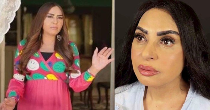 سلوى خطاب تكشف سبب خضوعها لعملية تجميل: الدهون كانت مضايقاني وشيلتها
