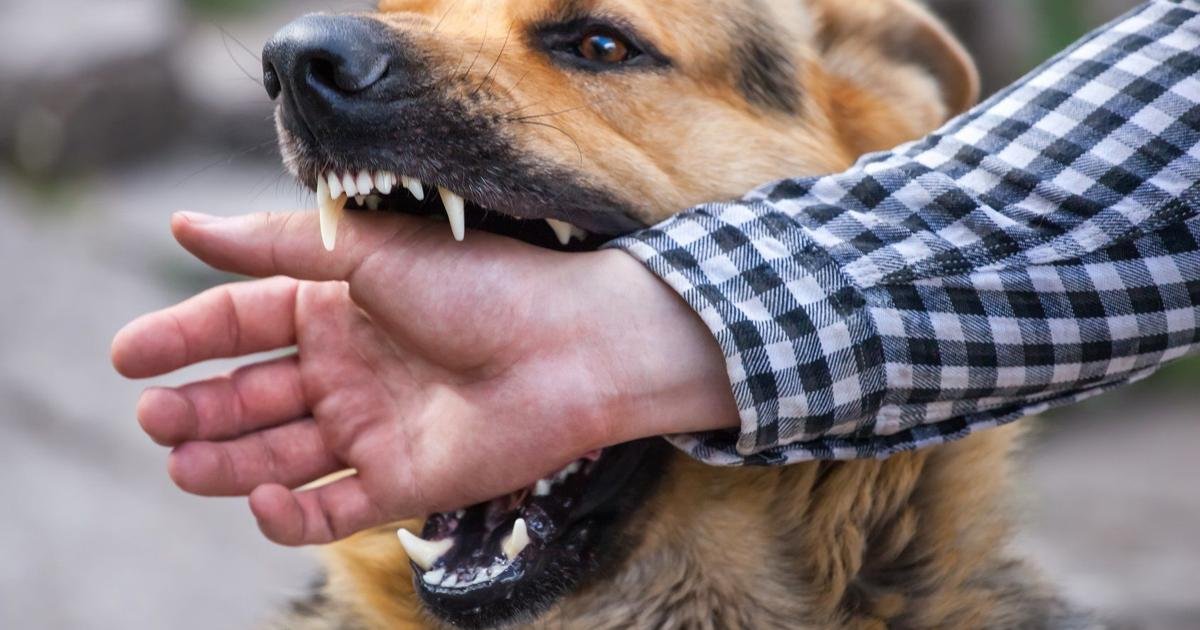 إصابة 8 أشخاص بينهم 3 أطفال في واقعة عقر كلب في الباجور بالمنوفية