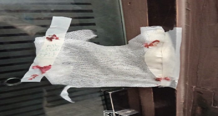 ضبط صيدلانية انتحلت صفة طبيبة تجميل وغلق مركز غير مرخص ببورسعيد