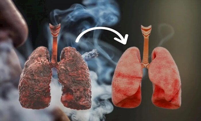 أقلعت عن التدخين؟ إليك الطرق الطبيعية لتنظيف رئتيك واستعادة كفاءتهما