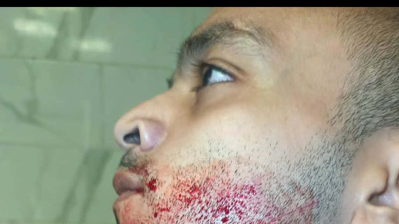 شاب يستغيث من خاله: باع ورثنا واعتدى علينا بسلاح أبيض بالعمرانية