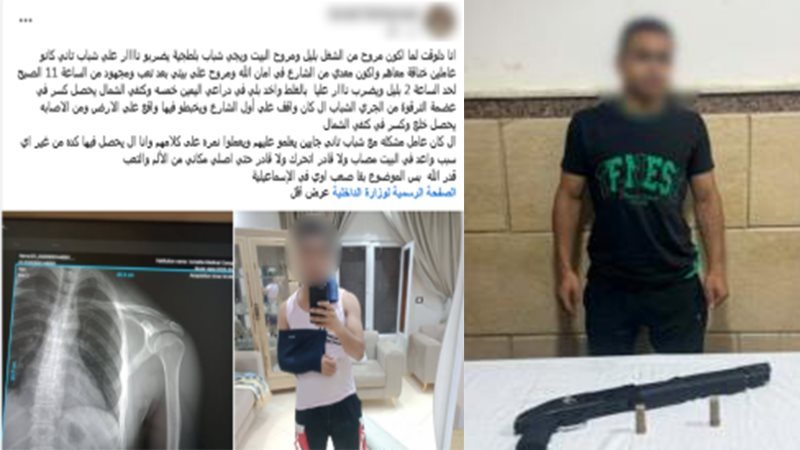 رصاصة طائشة تصيب شخصا أثناء مروره بالصدفة بجوار مشاجرة في الإسماعيلية، وضبط المتهم